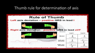 Clinical Basics of ECG rate rhythm and axis | PPTX