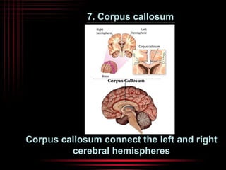 7. Corpus callosum 
Corpus callosum connect the left and right 
cerebral hemispheres 
 