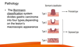Boreman Classification Rathod Gastric Cancer Presentation final.pptx