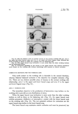 Rationale-and-technique-for-occlusal-equilibration.pdf