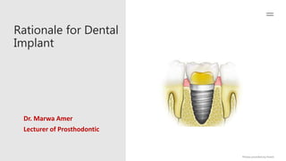 rationale for dental implant treatment.pptx