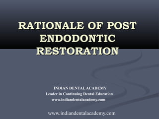 RATIONALE OF POST
   ENDODONTIC
  RESTORATION


       INDIAN DENTAL ACADEMY
   Leader in Continuing Dental Education
      www.indiandentalacademy.com


    www.indiandentalacademy.com
 