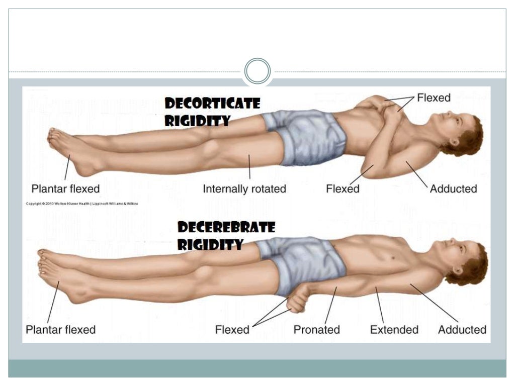 Rational prescription & emergency management of unconscious patient