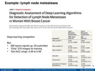 Den Haag, 21 Feb 2022 Twitter: @MaartenvSmeden
Example: lymph node metastases
Bejnordi et al, JAMA, 2018, doi: 10.1001/jama.2017.14585. See our letter to the editor for a critical discussion: https://bit.ly/2kcYS0e
Deep learning competition
But:
• 390 teams signed up, 23 submitted
• “Only” 270 images for training
• Test AUC range: 0.56 to 0.99
 