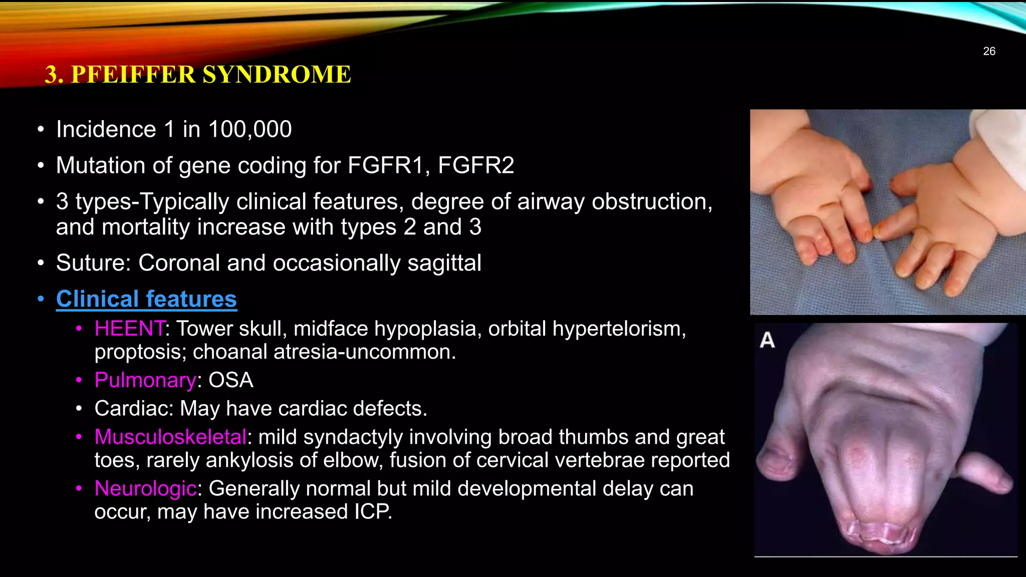 Anesthesia management of Craniosynostosis | PPTX