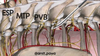 ESP
MTP PVB
@amit_pawa
 