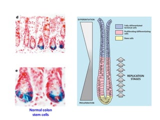 Normal	
  colon	
  
stem	
  cells
 