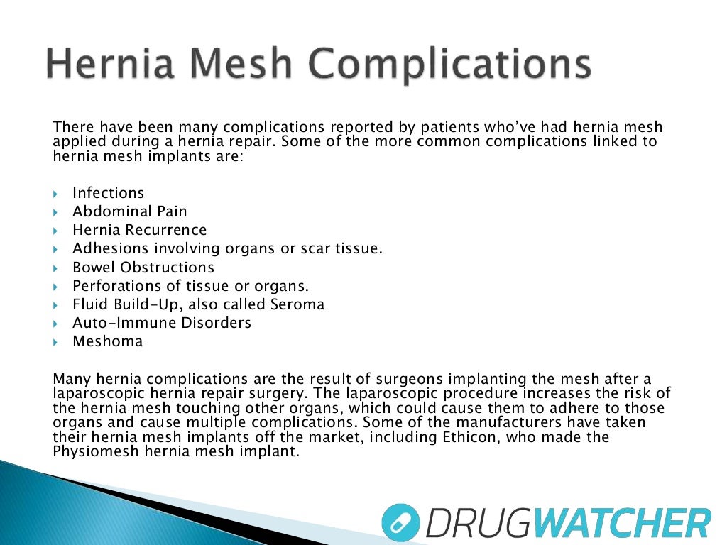 Hernia Mesh lawsuit updates