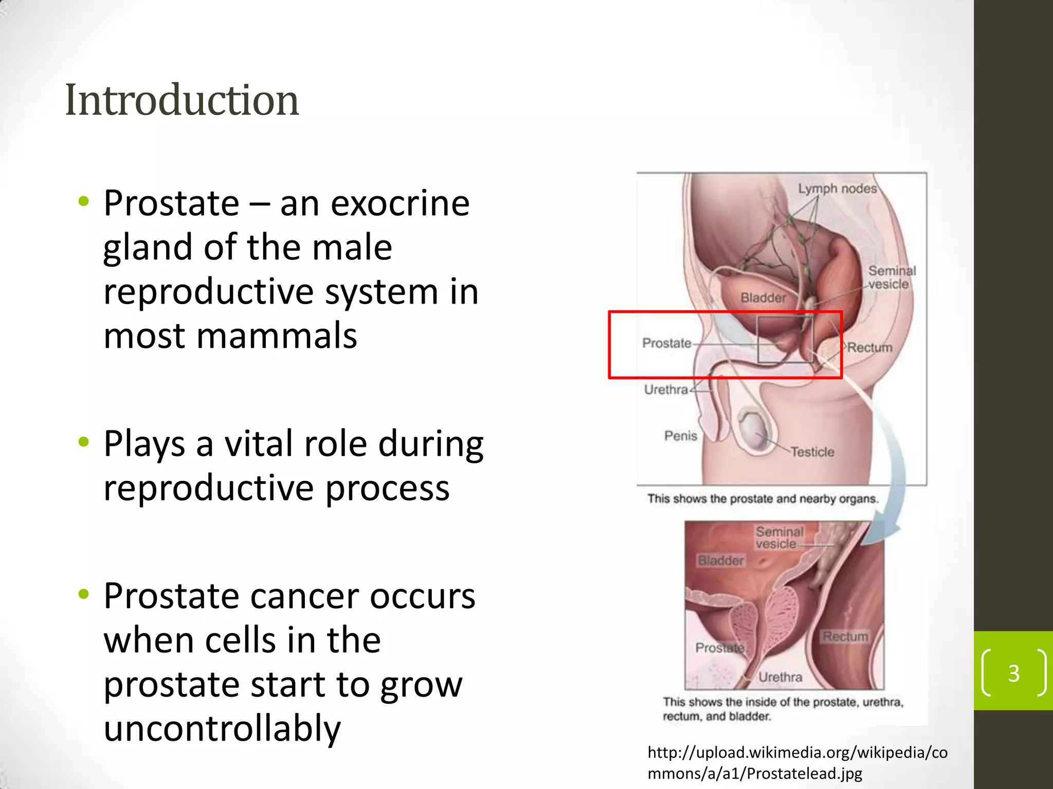 Introduction
• Prostate – an exocrine
gland of the male
reproductive system in
most mammals
• Plays a vital role during
reproductive process
• Prostate cancer occurs
when cells in the
prostate start to grow
uncontrollably
3
http://upload.wikimedia.org/wikipedia/co
mmons/a/a1/Prostatelead.jpg
 