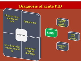 Diagnosis of acute PID
 
