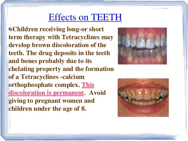 Tetracyclines Ravisankar Medicinal Chemistry Definition Classifi