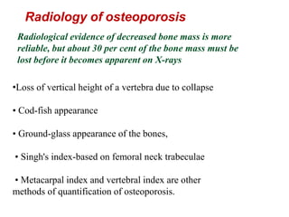 Metabolic Bone Diseases - RAVI | PPTX