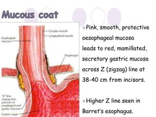Z Line Definition Z Line Esophagus