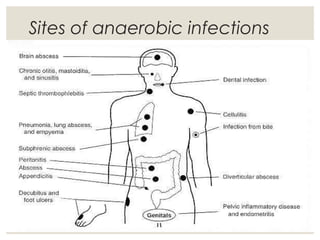 Sites of anaerobic infections
 