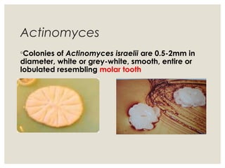 Actinomyces
◦Colonies of Actinomyces israelii are 0.5-2mm in
diameter, white or grey-white, smooth, entire or
lobulated resembling molar tooth
 