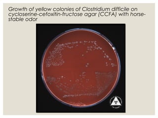 Growth of yellow colonies of Clostridium difficile on
cycloserine-cefoxitin-fructose agar (CCFA) with horse-
stable odor
 