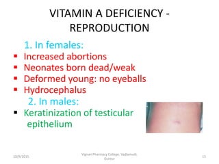 VITAMIN A DEFICIENCY -
REPRODUCTION
1. In females:
 Increased abortions
 Neonates born dead/weak
 Deformed young: no eyeballs
 Hydrocephalus
2. In males:
 Keratinization of testicular
epithelium
15
Vignan Pharmacy College, Vadlamudi,
Guntur
10/9/2015
 