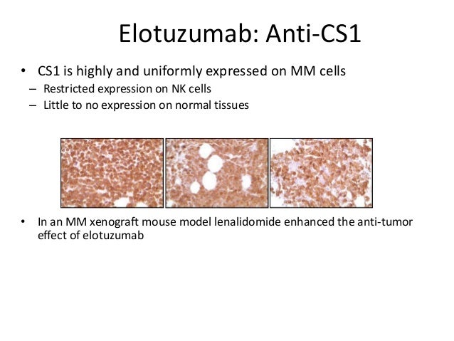 Multiple Myeloma Methylprednisolone