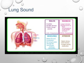6
Wheezes Stridor
Lung Sound
 