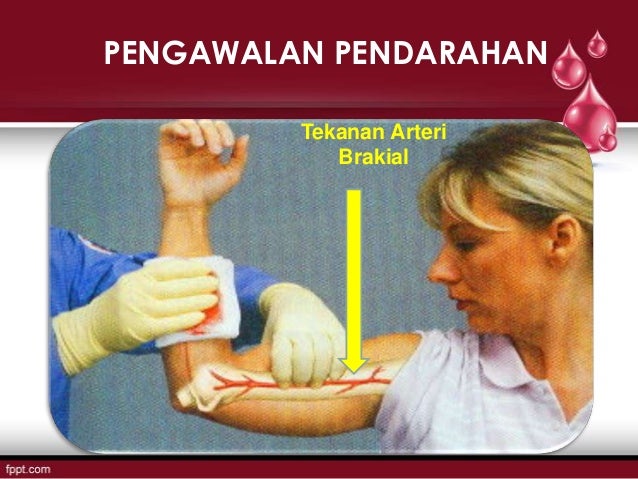 Rawatan Perdarahan