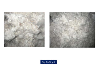 Fig: Doffing-2
 