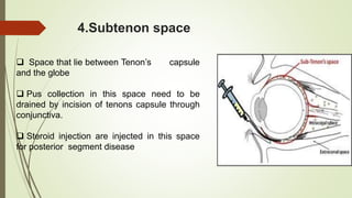 Tenon Injection Anatomy of human orbit | PPTX