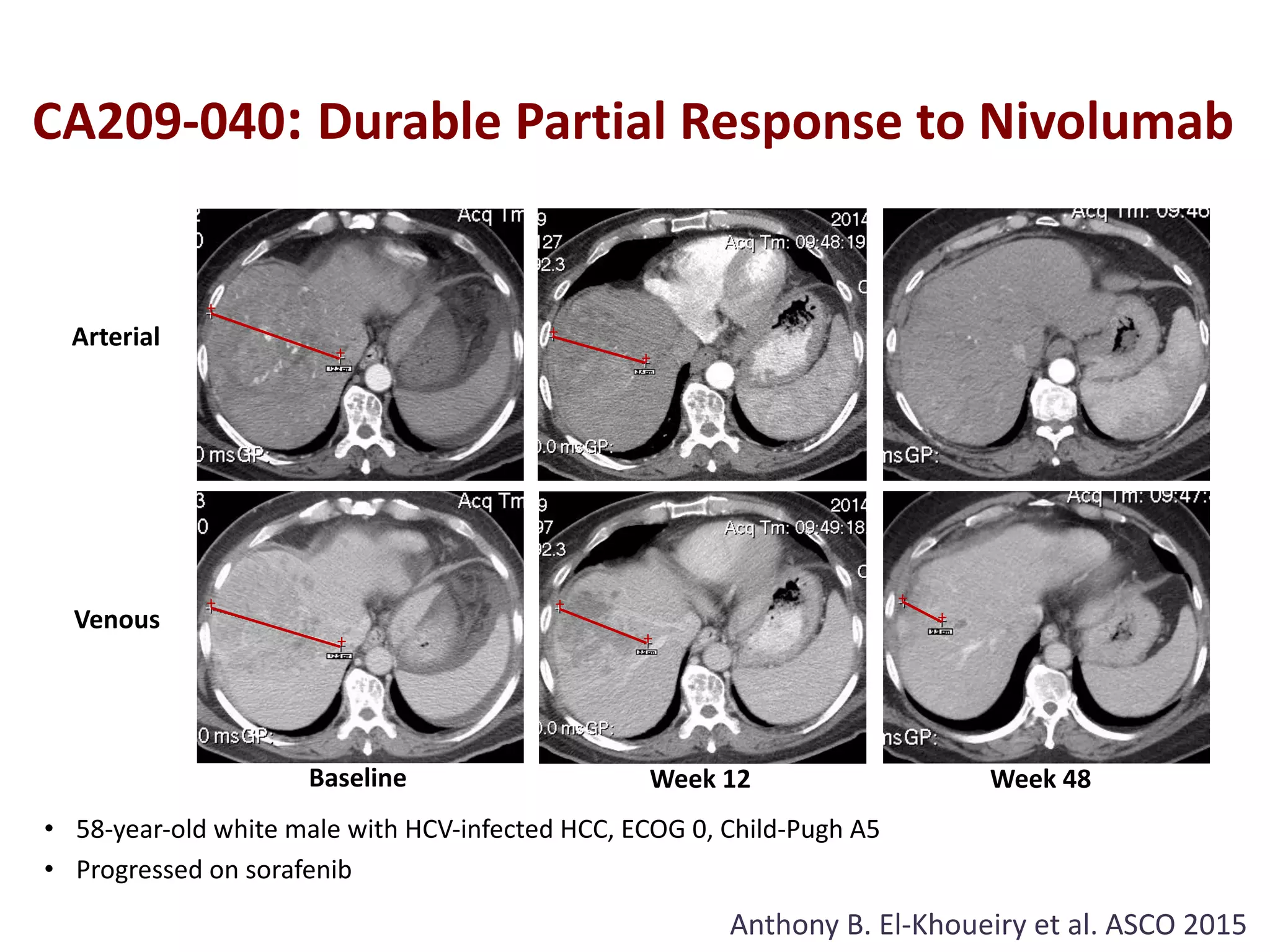 Understanding the landscape of progress in the treatment of ...