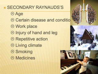    SECONDARY RAYNAUDS’S
      Age
      Certain disease and condition
      Work place
      Injury of hand and leg
      Repetitive action
      Living climate
      Smoking
      Medicines
 
