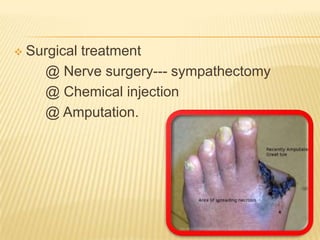    Surgical treatment
      @ Nerve surgery--- sympathectomy
      @ Chemical injection
      @ Amputation.
 