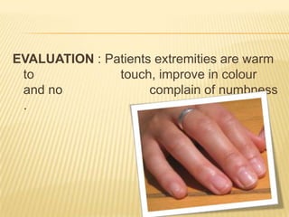 EVALUATION : Patients extremities are warm
 to            touch, improve in colour
 and no              complain of numbness
 .
 
