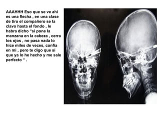 AAAHHH Eso que se ve ahí es una flecha , en una clase de tiro el compañero se la clavo hasta el fondo , le habra dicho “si pone la manzana en la cabeza , cerra los ojos , no pasa nada lo hice miles de veces, confia en mi , pero te digo que si que ya lo he hecho y me sale perfecto “ .  