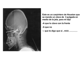 Este es un carpintero de Houston que se mando un clavo de  3 pulgada en medio de la jeta, para mi dijo  -A que lo clavo con la frente  A que no  –  que te digo que si , mirà ………… 