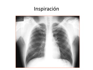Inspiración 
 
