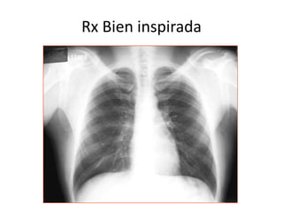 Rx Bien inspirada 
 