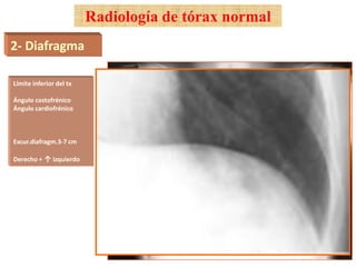 Radiología de tórax normal 
2- Diafragma 
Límite inferior del tx 
Ángulo costofrénico 
Ángulo cardiofrénico 
Excur.diafragm.3-7 cm 
Derecho + ↑ izquierdo 
 