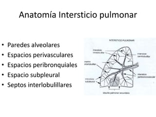 Anatomía Intersticio pulmonar 
• Paredes alveolares 
• Espacios perivasculares 
• Espacios peribronquiales 
• Espacio subpleural 
• Septos interlobulillares 
 