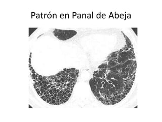 Patrón en Panal de Abeja 
 