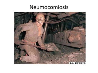 Neumocomiosis 
 