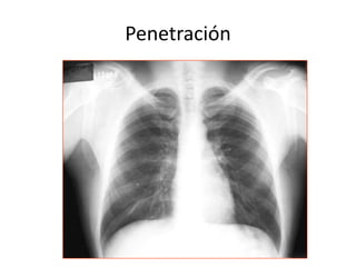 Penetración 
 