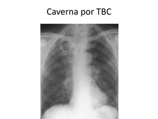 Caverna por TBC 
 