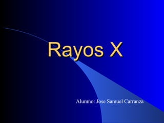 Rayos X Alumno: Jose Samuel Carranza 