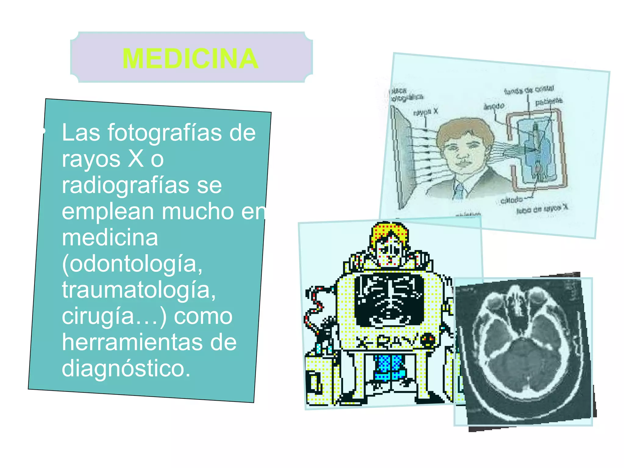 Las fotografías de rayos X o radiografías se emplean mucho en medicina (odontología, traumatología, cirugía…) como herramientas de diagnóstico.  MEDICINA   