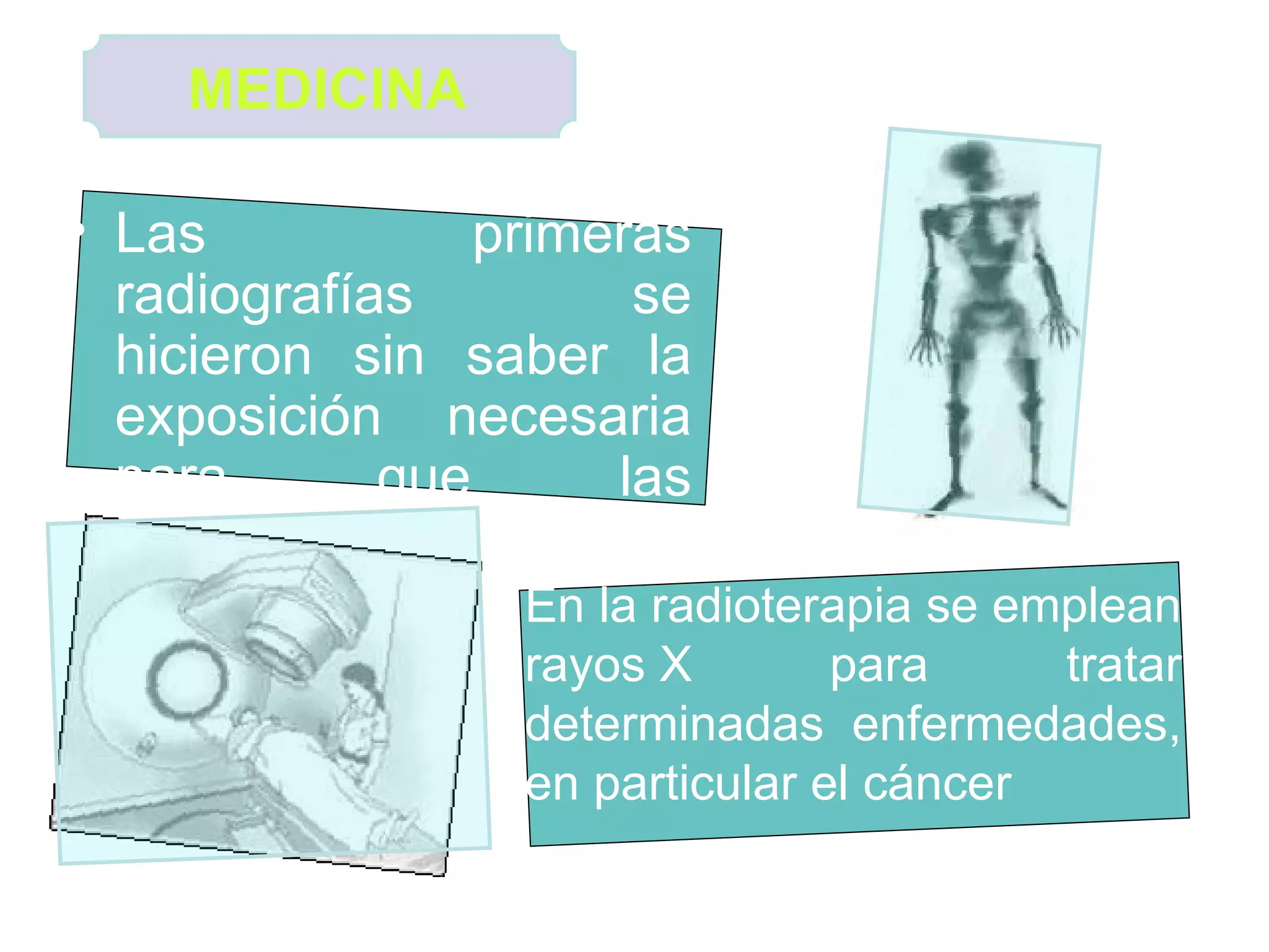 Las primeras radiografías se hicieron sin saber la exposición necesaria para que las fotografías fueran claras MEDICINA   En la radioterapia se emplean rayos X para tratar determinadas enfermedades, en particular el cáncer  