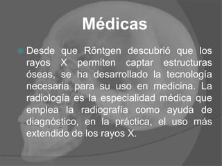 Médicas
 Desde que Röntgen descubrió que los
rayos X permiten captar estructuras
óseas, se ha desarrollado la tecnología
necesaria para su uso en medicina. La
radiología es la especialidad médica que
emplea la radiografía como ayuda de
diagnóstico, en la práctica, el uso más
extendido de los rayos X.
 