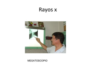 Rayos x
MEGATOSCOPIO
 