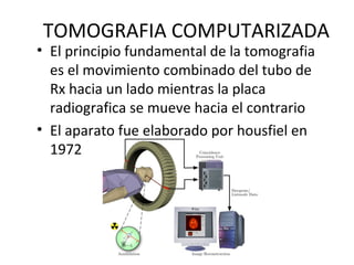 TOMOGRAFIA COMPUTARIZADA
• El principio fundamental de la tomografia
es el movimiento combinado del tubo de
Rx hacia un lado mientras la placa
radiografica se mueve hacia el contrario
• El aparato fue elaborado por housfiel en
1972
 