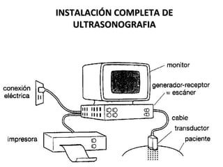 INSTALACIÓN COMPLETA DEINSTALACIÓN COMPLETA DE
ULTRASONOGRAFIAULTRASONOGRAFIA
 
