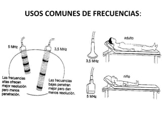 USOS COMUNES DE FRECUENCIAS:
 
