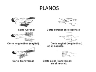 PLANOS
Corte Coronal Corte coronal en el neonato
Corte longitudinal (sagital) Corte sagital (longitudinal)
en el neonato
Corte Transversal Corte axial (transversal)
en el neonato
 