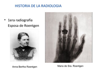 HISTORIA DE LA RADIOLOGIA
• 1era radiografía
Esposa de Roentgen
Anna Bertha Roentgen Mano de Sra. Roentgen
 